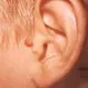 Picture of Auricular Tags 