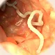 How Do You Get Rid of Tapeworms Naturally?