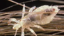 Head Lice